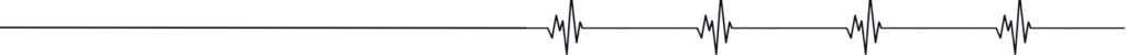 en bild av ett ekg med hjärtstopp som sedan startats